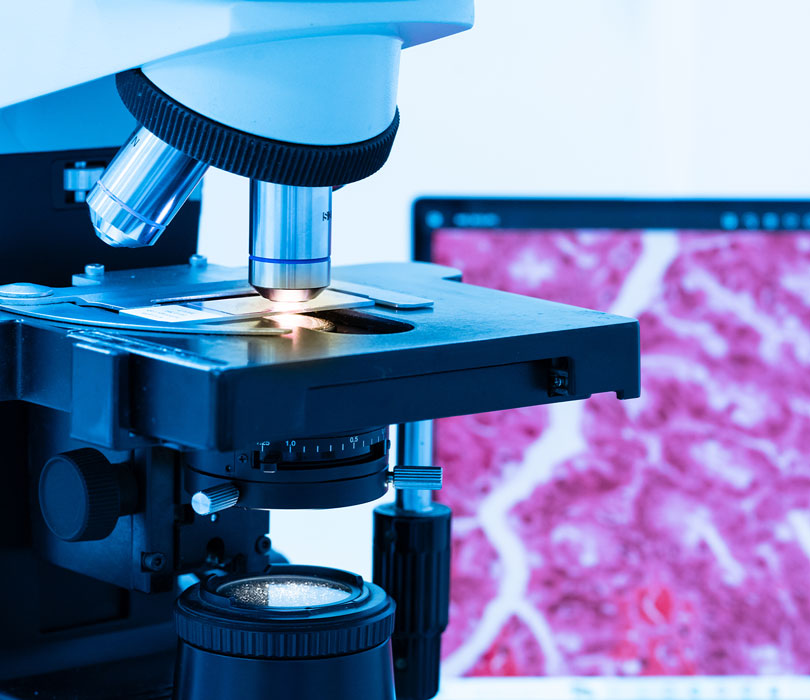 Microscope with cells on monitor