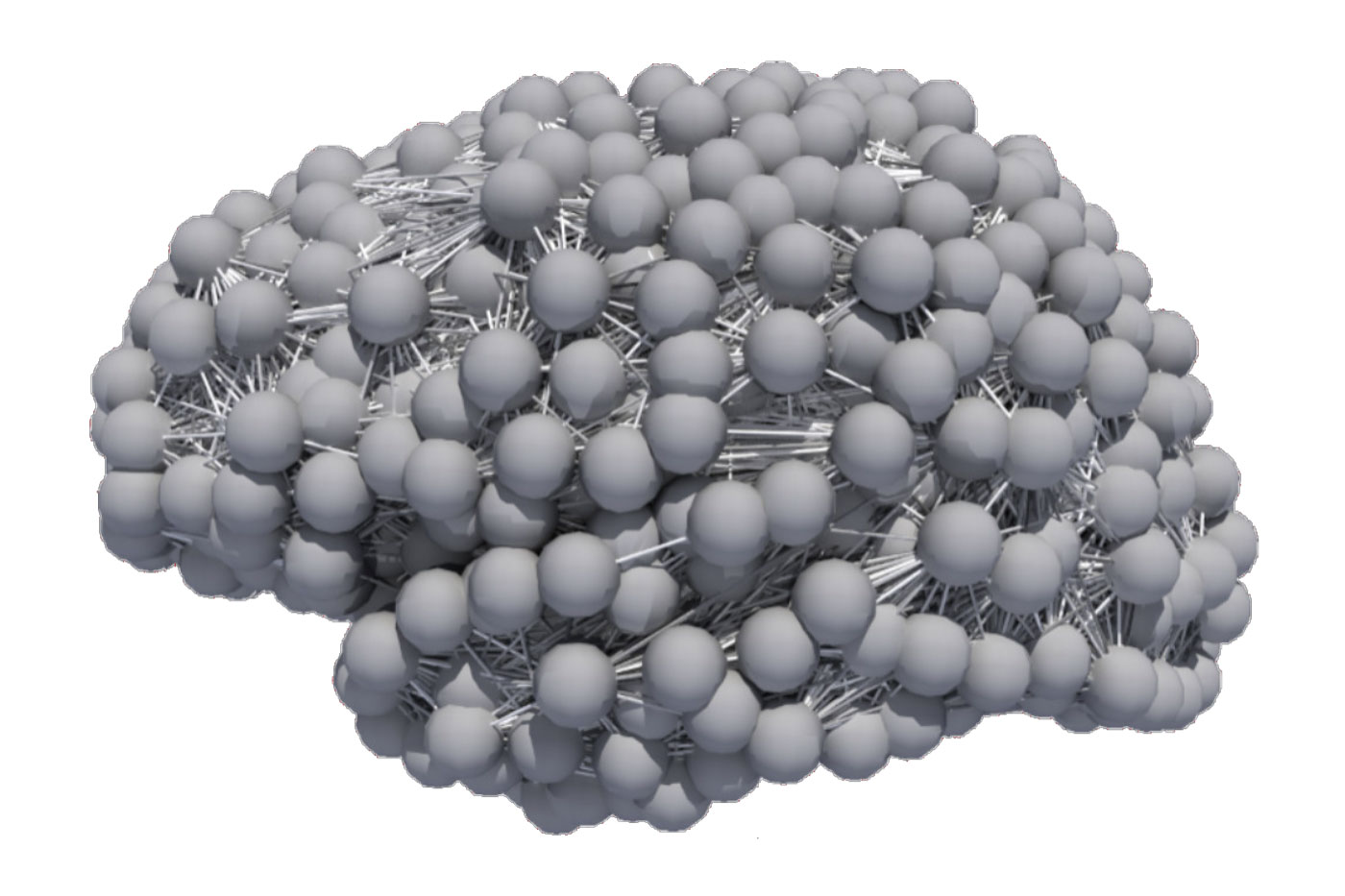 A human brain graph constructed from patient clinical imaging data.